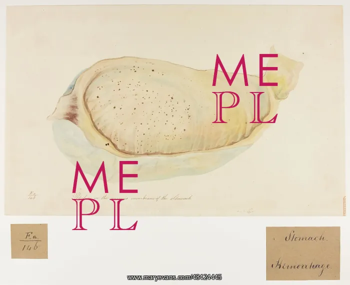 : Petechia on the Mucous Membrane of the Stomach : Petechia on the Mucous Membrane of the Stomach