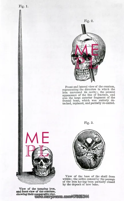 : Phineas Gage's skull and iron bar : Phineas Gage's skull and iron bar
