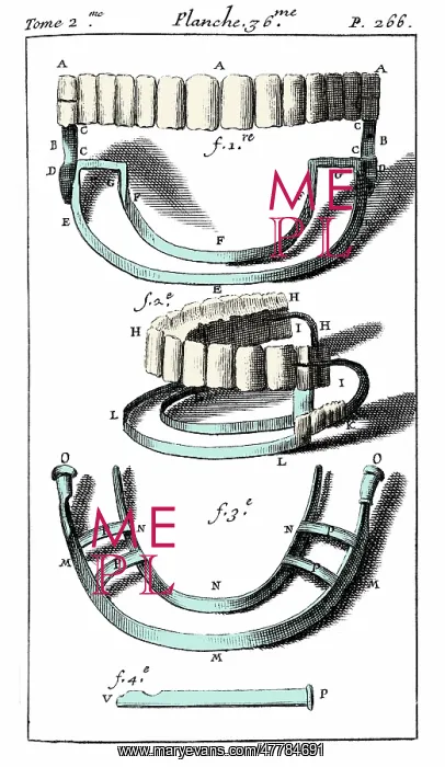 : Pierre Fauchard, Dentures, 1728 : Pierre Fauchard, Dentures, 1728