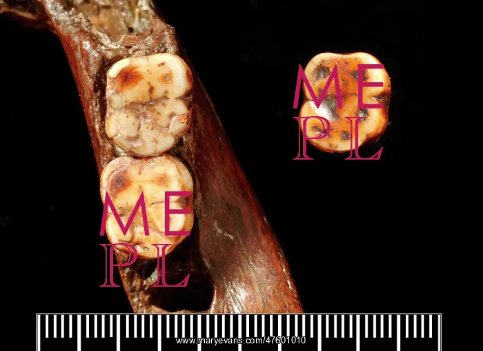 : Piltdown 1 jaw with Piltdown 2 molar : Piltdown 1 jaw with Piltdown 2 molar