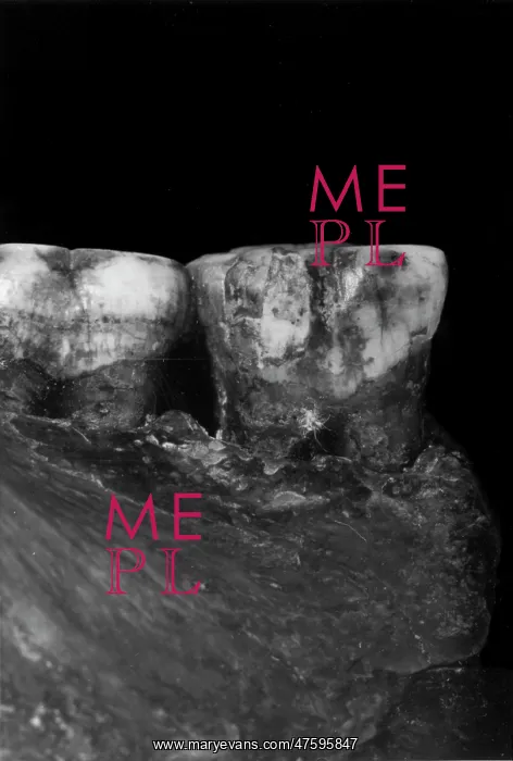 : Piltdown 1 molars : Piltdown 1 molars