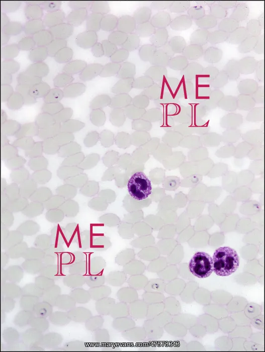 : Plasmodium sp. malarial parasite : Plasmodium sp. malarial parasite