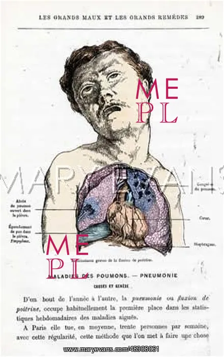 : PNEUMONIA SUFFERER : PNEUMONIA SUFFERER