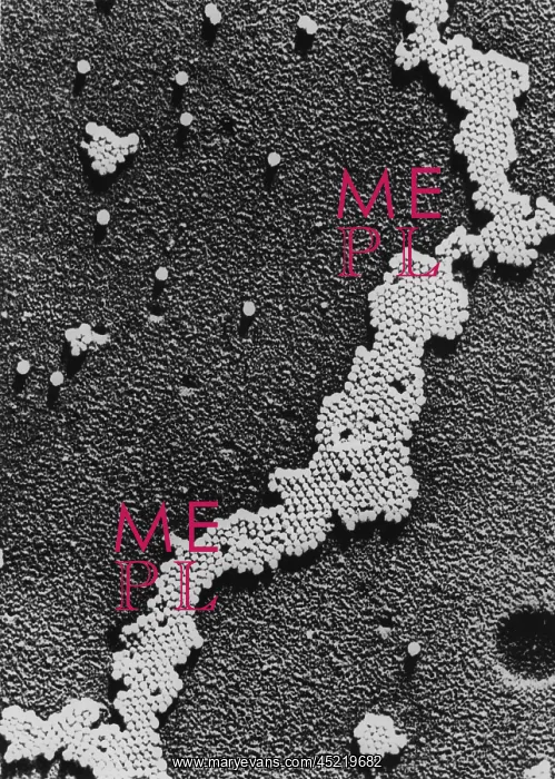 : Polio (Poliomyelitis) virus, the cause of ? : Polio (Poliomyelitis) virus, the cause of ?