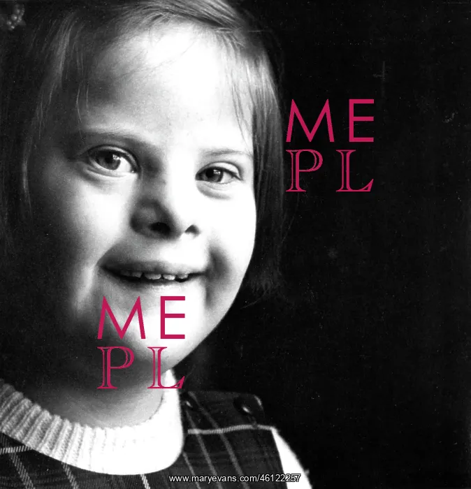 : Portrait girl with downs smiles to camera : Portrait girl with downs smiles to camera