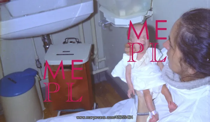 : Premature baby with mother : Premature baby with mother