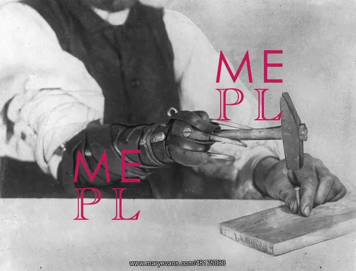 : Prosthesis of a German war veteran, 1917 : Prosthesis of a German war veteran, 1917