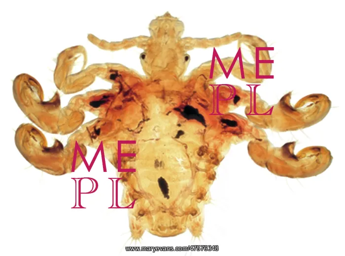 : Pthirus pubis, crab louse : Pthirus pubis, crab louse