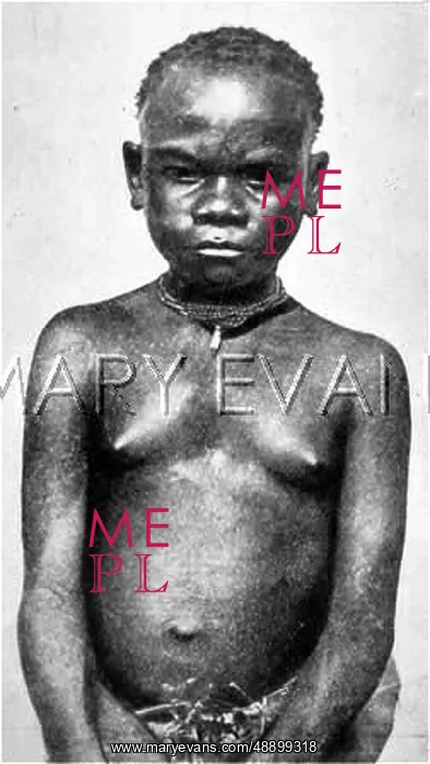  : RACIAL / C AFRICA / AKKA