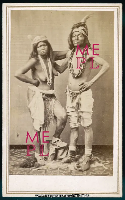 : RACIAL / DIGGER COUPLE : RACIAL / DIGGER COUPLE