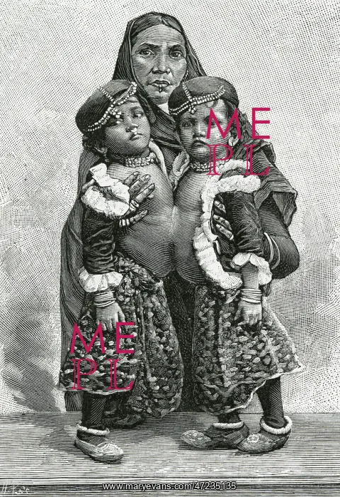 : RADICA & DOODICA : RADICA & DOODICA