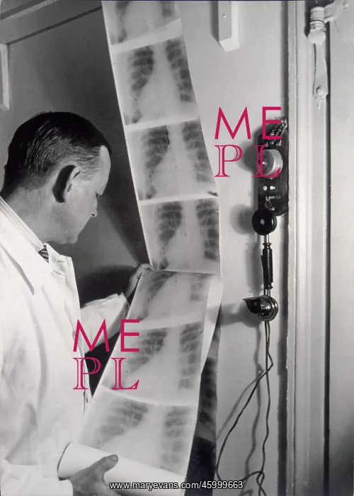 : Radiographs at Kerckhoff institute : Radiographs at Kerckhoff institute