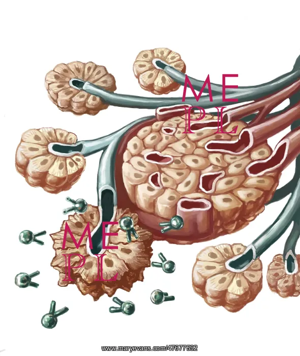 : Radioimmunotherapy, Illustration : Radioimmunotherapy, Illustration
