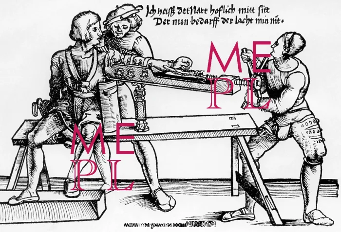 : Relocating a shoulder, 1528 : Relocating a shoulder, 1528