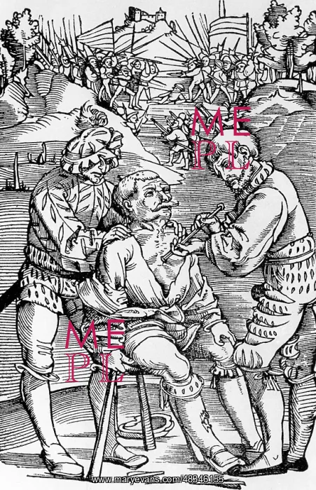 : Removal of an arrow, 1528 : Removal of an arrow, 1528