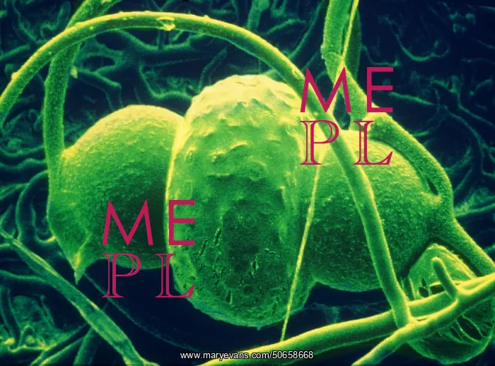 : Rhizopus sexualis, SEM : Rhizopus sexualis, SEM