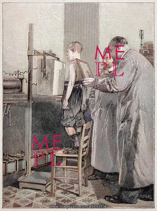 : Roentgen x-rays a patient 1896 : Roentgen x-rays a patient 1896