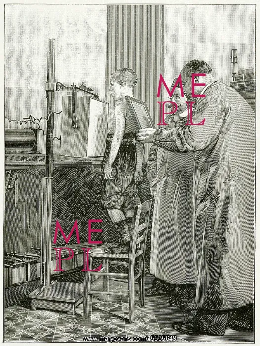 : Roentgen x-rays a patient 1896 : Roentgen x-rays a patient 1896