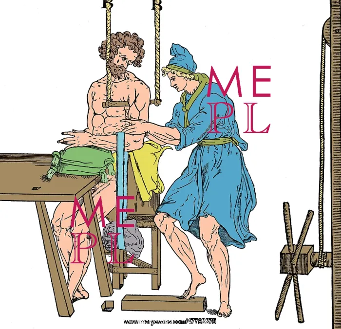 : Roman Devices for Setting Fractures : Roman Devices for Setting Fractures