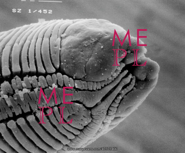 : Roundworm. Scanning electron microscope (SEM) image of a parasitic roundworm's head : Roundworm. Scanning electron microscope (SEM) image of a parasitic roundworm's head
