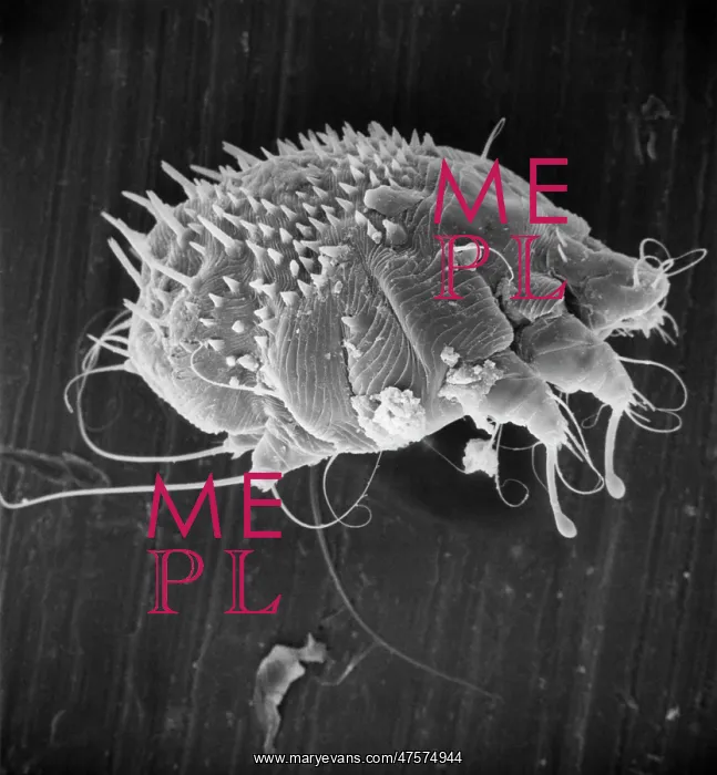 : Sarcoptes scabiei, scabies mite : Sarcoptes scabiei, scabies mite