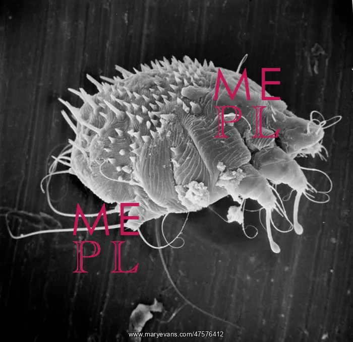 : Sarcoptes scabiei, scabies mite : Sarcoptes scabiei, scabies mite