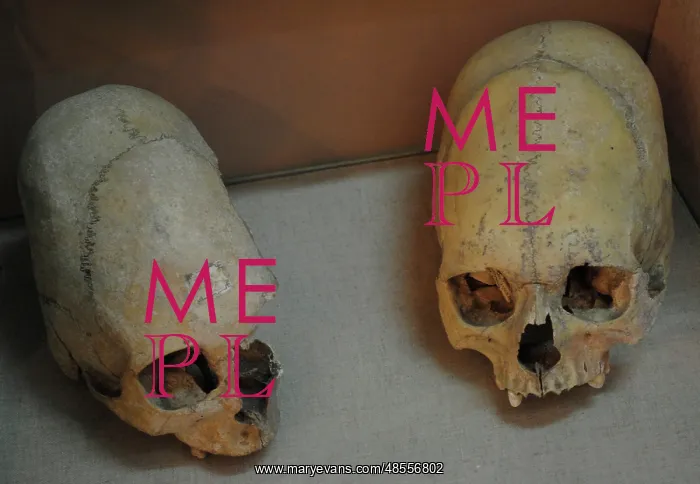 : Sarmatians. Deformed human skulls. Probably dated in the 3rd : Sarmatians. Deformed human skulls. Probably dated in the 3rd