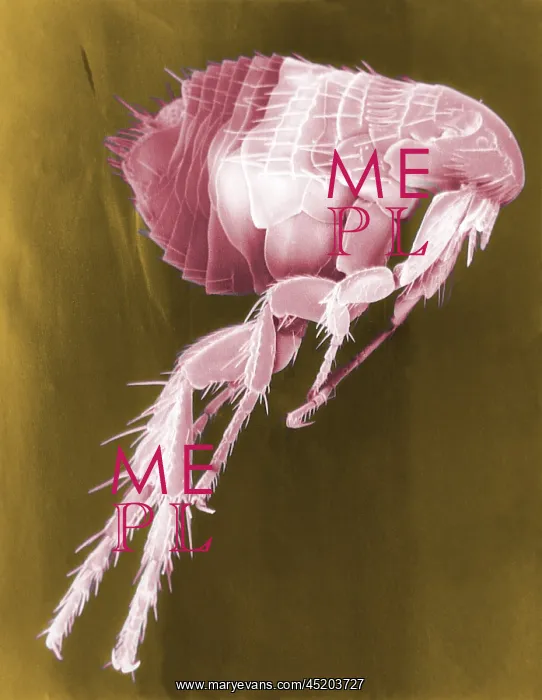 : Scanning Electron Micrograph of a Flea. ? : Scanning Electron Micrograph of a Flea. ?