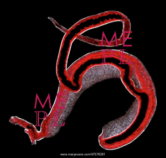 : Schistosoma spp. blood flukes : Schistosoma spp. blood flukes