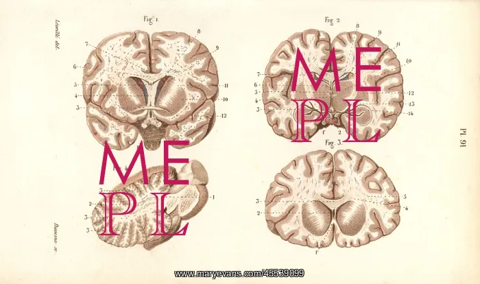 : Sections through the brain : Sections through the brain