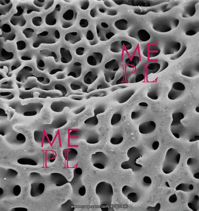 : SEM of echinoderm steroem : SEM of echinoderm steroem