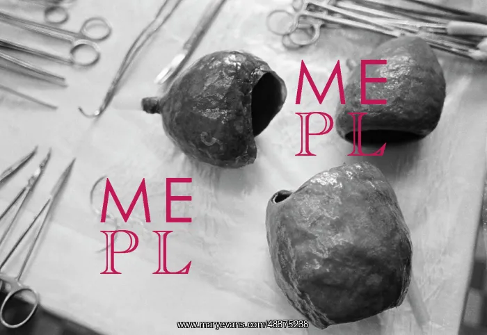 : Set of pacemakers : Set of pacemakers