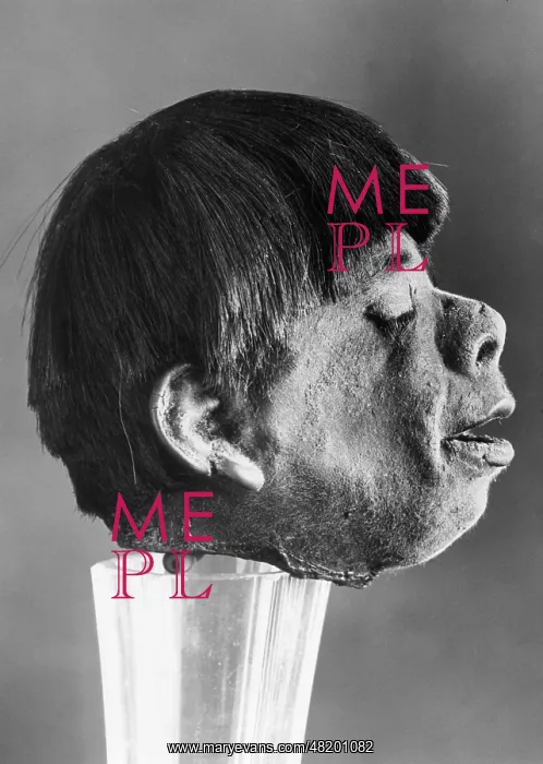 : A shrunken head, 1930 : A shrunken head, 1930