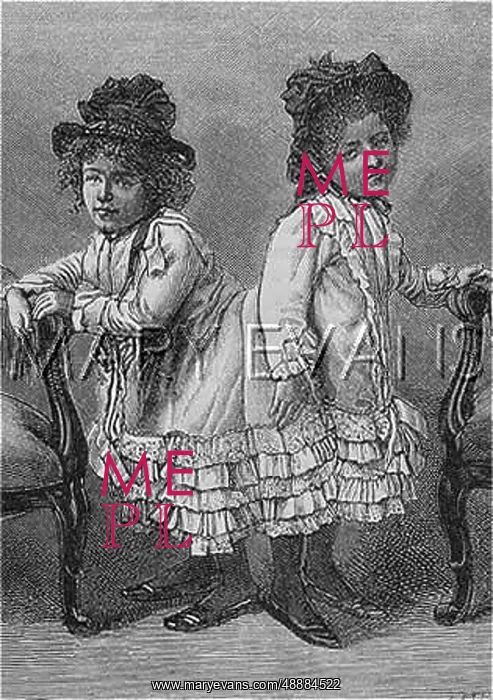 : Siamese twins from Bohemia : Siamese twins from Bohemia