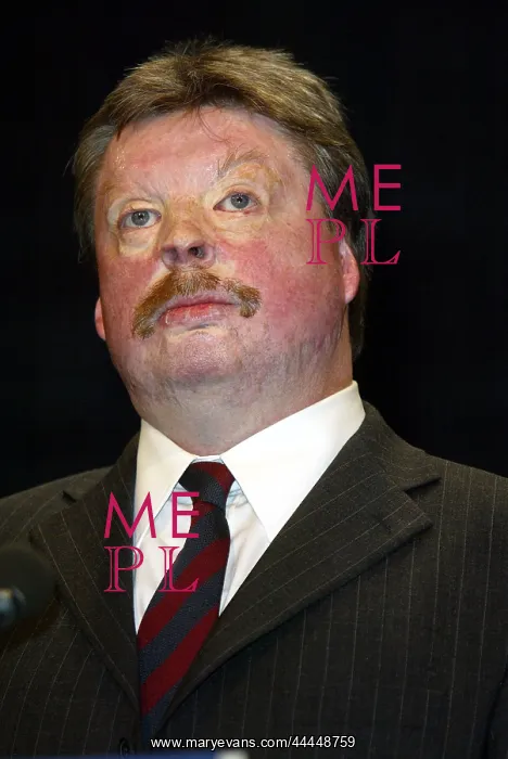  : Simon Weston