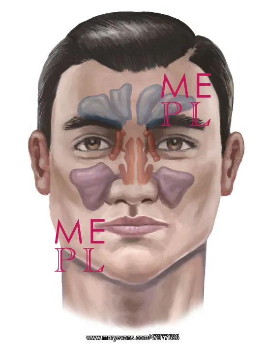 : Sinuses, Illustration : Sinuses, Illustration