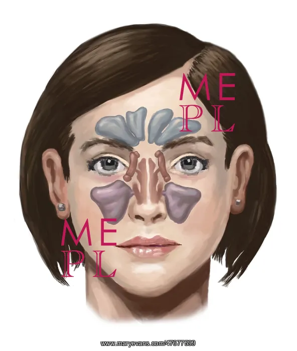 : Sinuses, Illustration : Sinuses, Illustration