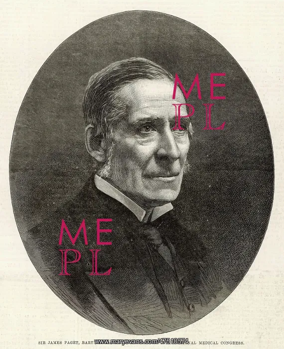 : SIR JAMES PAGET : SIR JAMES PAGET