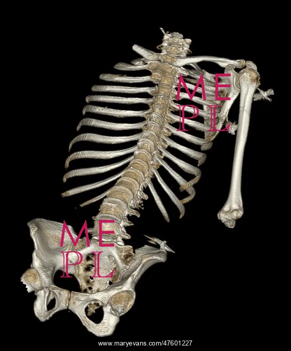 : Skeletal Reconstruction : Skeletal Reconstruction