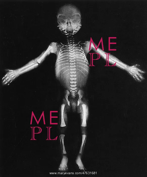 : Skeleton of a baby : Skeleton of a baby