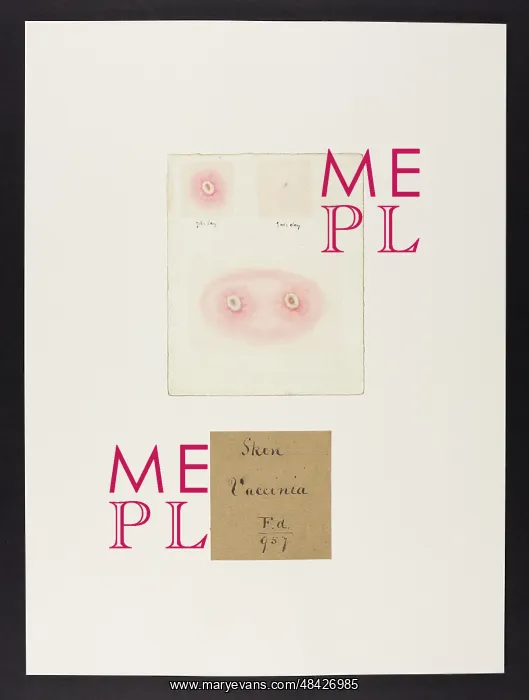 : Skin : Vaccinia : Skin : Vaccinia