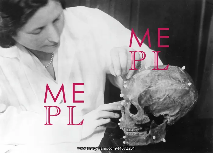  : SKULL RECONSTRUCTION
