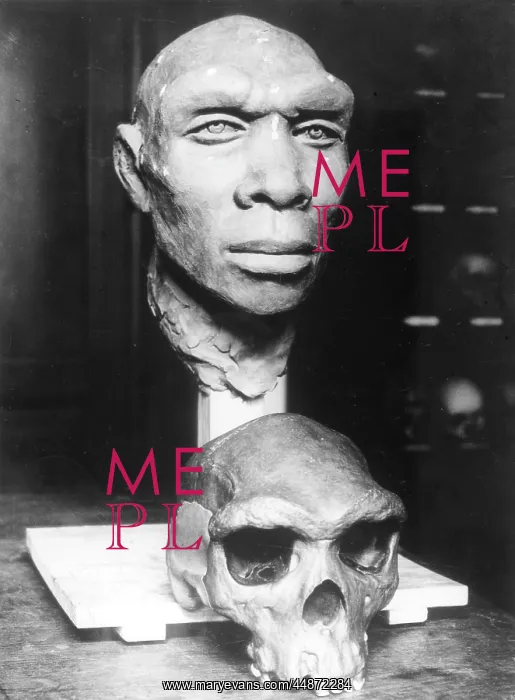 : SKULL RECONSTRUCTION : SKULL RECONSTRUCTION