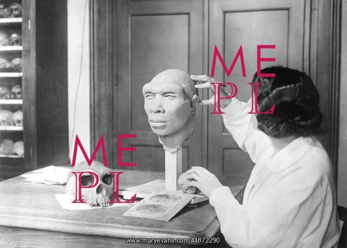 : SKULL RECONSTRUCTION : SKULL RECONSTRUCTION