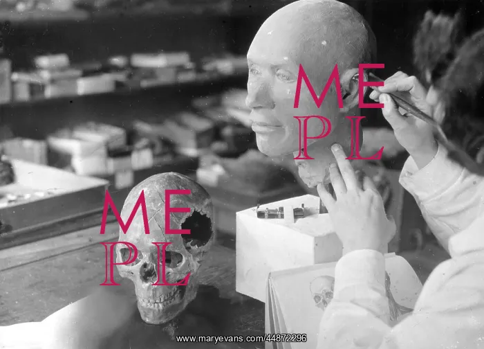 : SKULL RECONSTRUCTION : SKULL RECONSTRUCTION