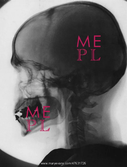 : Skull x-ray : Skull x-ray