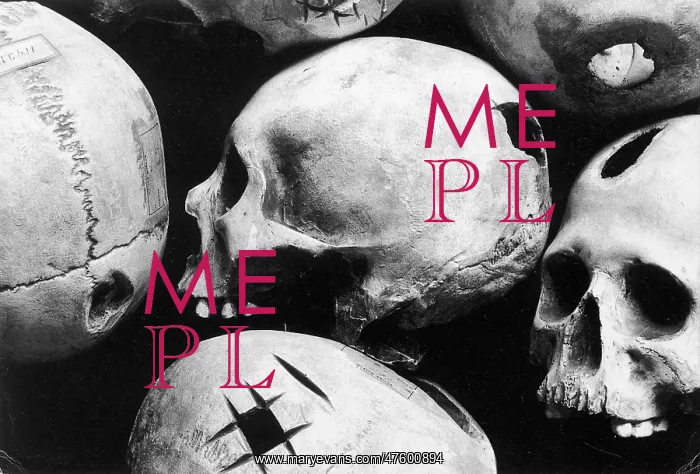 : Skulls Showing Trepanation : Skulls Showing Trepanation