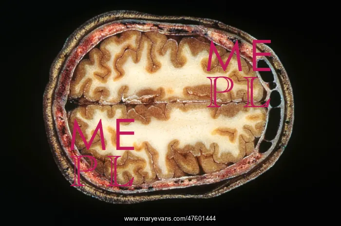 : Slice of Human Brain : Slice of Human Brain
