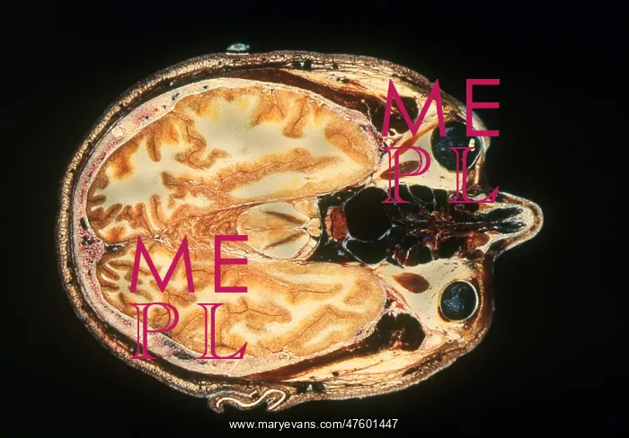 : Slice of Human Brain : Slice of Human Brain
