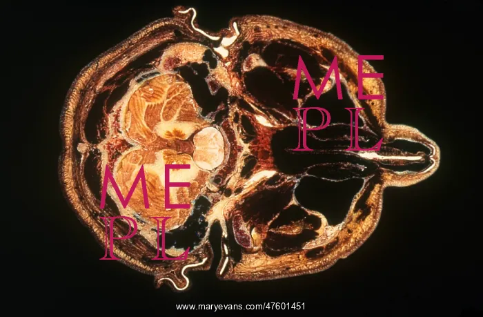 : Slice of Human Brain : Slice of Human Brain